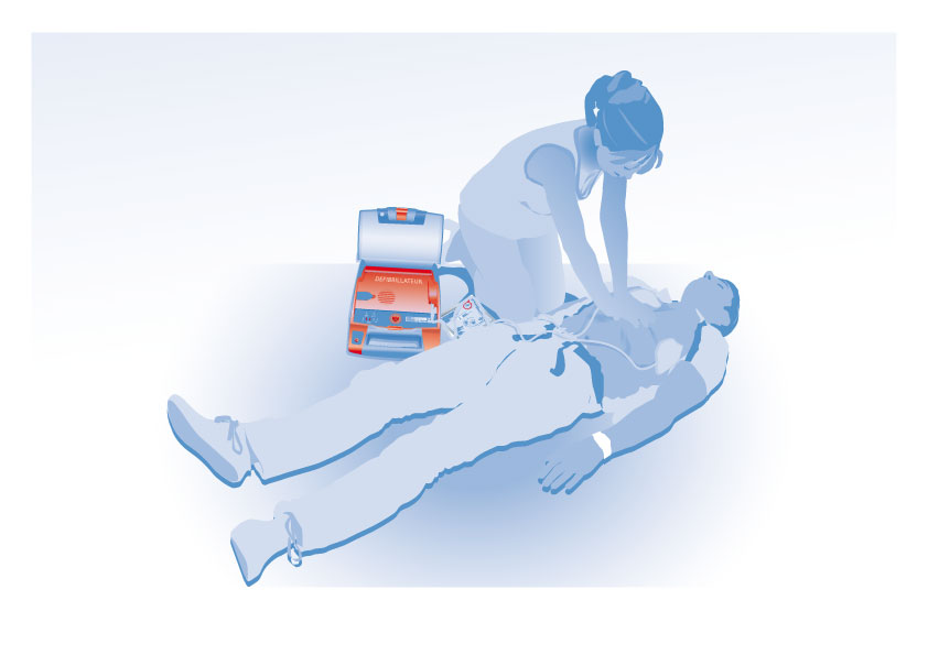 Illustration Defibrillateur